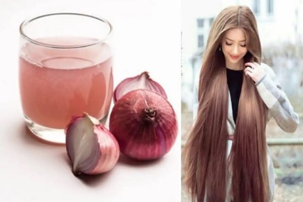 پیاز برای پوست و مو