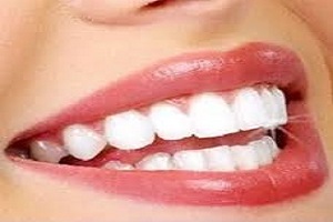 دندان سفید براق با روش های بسیار ساده + تصاویر
