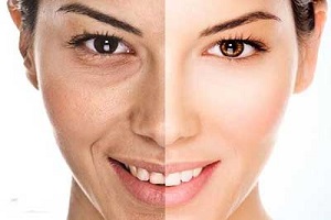 چین و چروکهای پوستی را با کمک این ماسک ارگانیک کاهش دهید