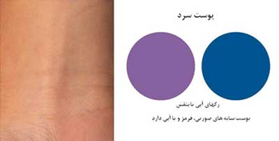 نکات مهم برای زیر سازی پوست زیر سازی پوست