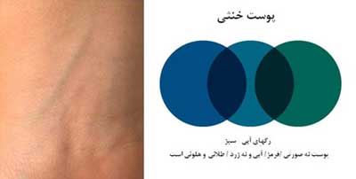 زیر سازی پوست