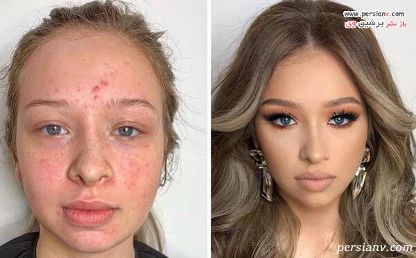 آرایش صورت های جراحت دار