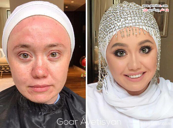 آرایش روی صورت بیمار
