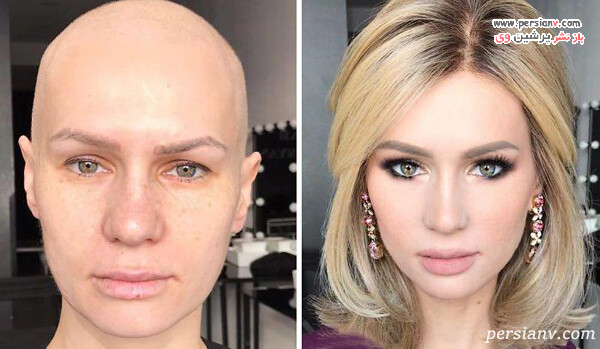 آرایش روی صورت بیمار