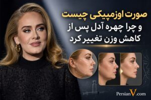 «صورت اوزمپیکی» چیست ؟ عکسهای قبل و بعد آدل خواننده مشهور انگلیسی از رژیم های لاغری