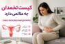 کیست تخمدان چه علائمی دارد