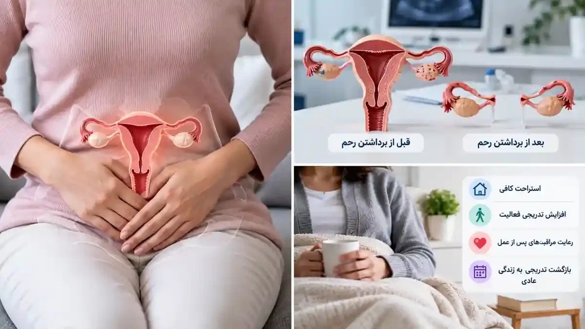 عوارض برداشتن رحم عوارض برداشتن رحم