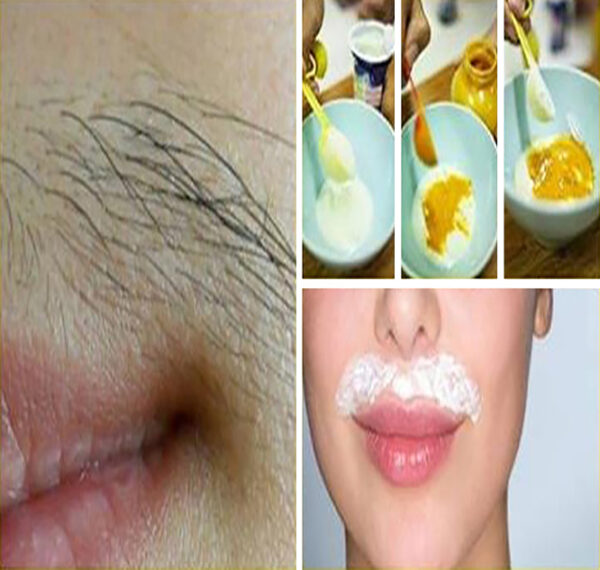 روش از بین بردن موهای زائد پشت لب