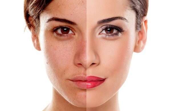 ماسک برای رفع کدری پوست