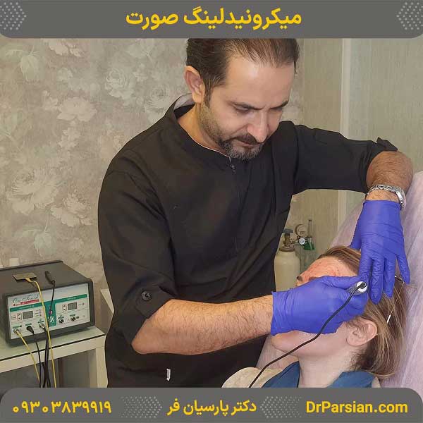 انجام میکرونیدلینگ صورت توسط دکتر سعید پارسیان فر